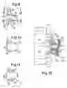 Fig. 04 - Interlaminar vertebral prosthesis