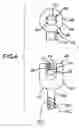 Fig. 04 - Pedicle screw based vertebral body stabilization apparatus