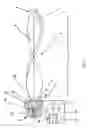 Fig. 03 - Fixation device for bones