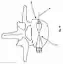 Fig. 10 - Fixation device for bones