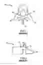 Fig. 02 - Spinal stabilization