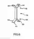 Fig. 06 - Spinal stabilization
