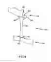 Fig. 08 - Spinal stabilization