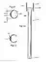 Fig. 35 - Minimally invasive access device and method