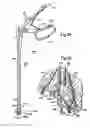 Fig. 44 - Minimally invasive access device and method
