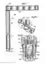Fig. 45 - Minimally invasive access device and method