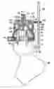 Fig. 01 - Guide wire location means for the insertion of a prosthetic hip resurfacing