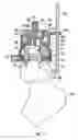 Fig. 02 - Guide wire location means for the insertion of a prosthetic hip resurfacing