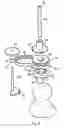 Fig. 05 - Guide wire location means for the insertion of a prosthetic hip resurfacing
