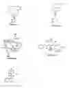 Fig. 01 - Method for reducing the risk of posterior capsular opacification
