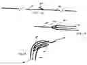 Fig. 08 - CATHETER CAPTURE DEVICE