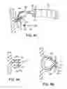 Fig. 11 - Methods and apparatus for securing and deploying tissue anchors