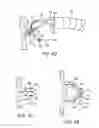 Fig. 11 - Methods and apparatus for securing and deploying tissue anchors