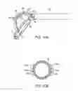 Fig. 12 - Methods and apparatus for securing and deploying tissue anchors