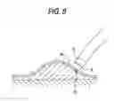 Fig. 07 - High frequency treatment tool