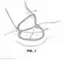 Fig. 02 - Apparatus and methods for valve repair
