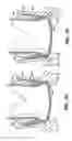Fig. 08 - Apparatus and methods for valve repair