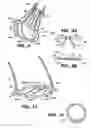 Fig. 12 - Apparatus and methods for valve repair