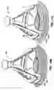 Fig. 20 - Apparatus and methods for valve repair