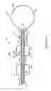 Fig. 09 - Percutaneous intragastric balloon device and method