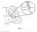 Fig. 02 - Methods and apparatus to achieve a closure of a layered tissue defect
