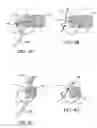 Fig. 05 - Methods and apparatus to achieve a closure of a layered tissue defect