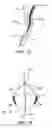 Fig. 12 - Methods and apparatus to achieve a closure of a layered tissue defect