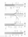 Fig. 13 - Methods and apparatus to achieve a closure of a layered tissue defect