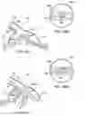 Fig. 28 - Methods and apparatus to achieve a closure of a layered tissue defect