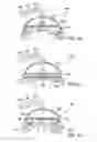 Fig. 29 - Methods and apparatus to achieve a closure of a layered tissue defect