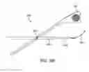 Fig. 36 - Methods and apparatus to achieve a closure of a layered tissue defect