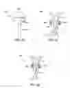 Fig. 37 - Methods and apparatus to achieve a closure of a layered tissue defect