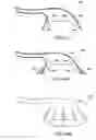 Fig. 38 - Methods and apparatus to achieve a closure of a layered tissue defect
