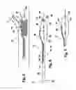 Fig. 03 - Vessel treatment devices