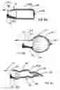 Fig. 05 - Balloon catheter device