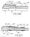Fig. 08 - Balloon catheter device