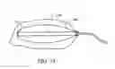 Fig. 22 - Hemostatic system for body cavities