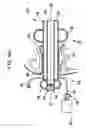 Fig. 06 - Apparatus and method of maintaining insufflation