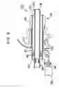 Fig. 16 - Apparatus and method of maintaining insufflation