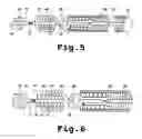 Fig. 05 - Electrolytically detachable implantable devices