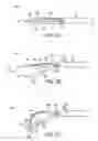 Fig. 03 - Methods and apparatus for securing and deploying tissue anchors