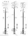 Fig. 18 - Methods and apparatus for securing and deploying tissue anchors