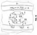 Fig. 11 - Apparatus and methods for magnetic alteration of anatomical features
