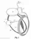 Fig. 02 - Automatic fitting for a visual prosthesis