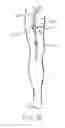 Fig. 06 - Apparatus and system to stimulate a nerve