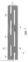 Fig. 02 - Electromagnetic interference immune pacing/defibrillation lead