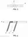 Fig. 06 - Electromagnetic interference immune pacing/defibrillation lead