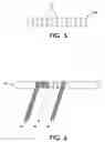 Fig. 06 - Electromagnetic interference immune pacing/defibrillation lead