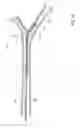 Fig. 06 - Catheter system for stenting bifurcated vessels