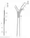 Fig. 11 - Catheter system for stenting bifurcated vessels